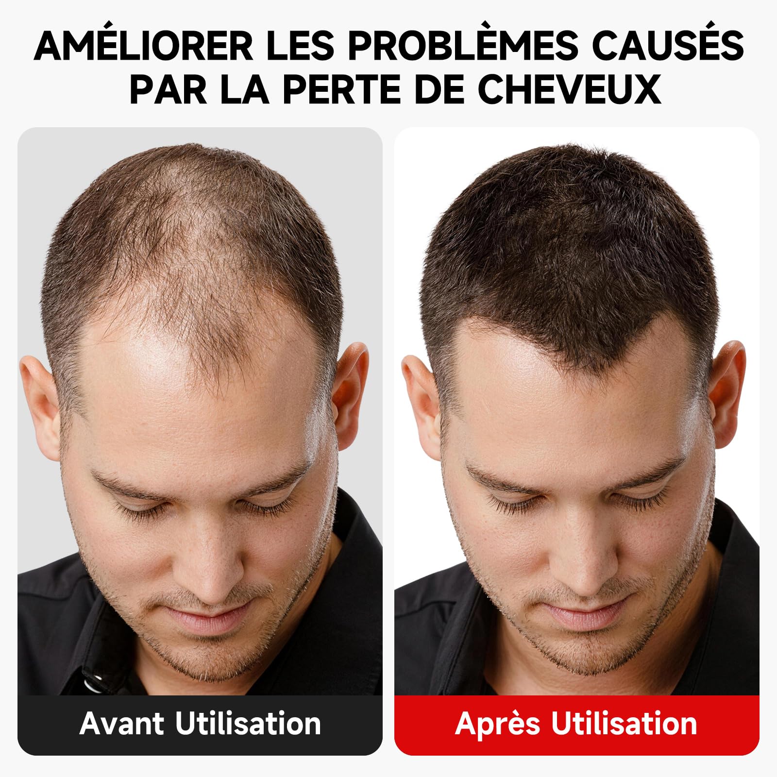 Casque LED Cheveux,Casque Pousse Cheveux,7 Modes Casque De Croissance De Cheveux 660nm+850nm, Sans fil Casque Anti Calvitie,Accélérer La Croissance Des Cheveux pour Femme Homme