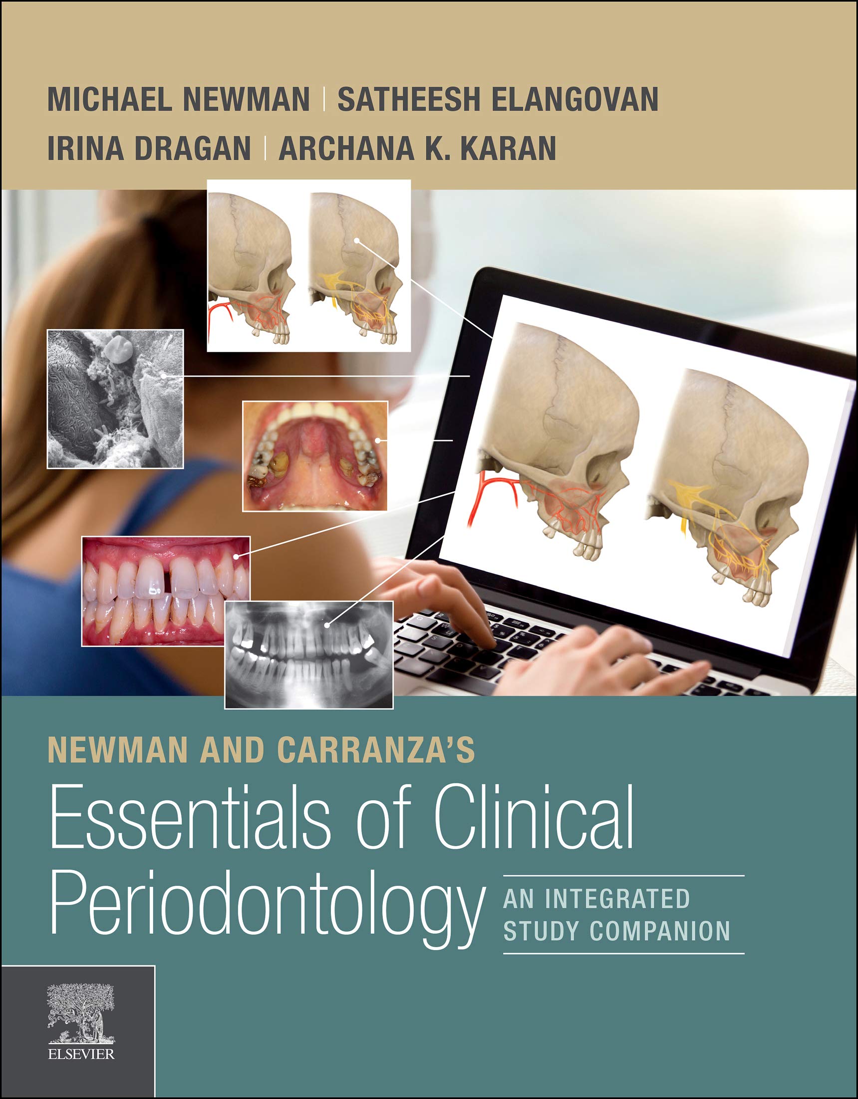 Newman and Carranza's Essentials of Clinical Periodontology E-Book (English Edition)