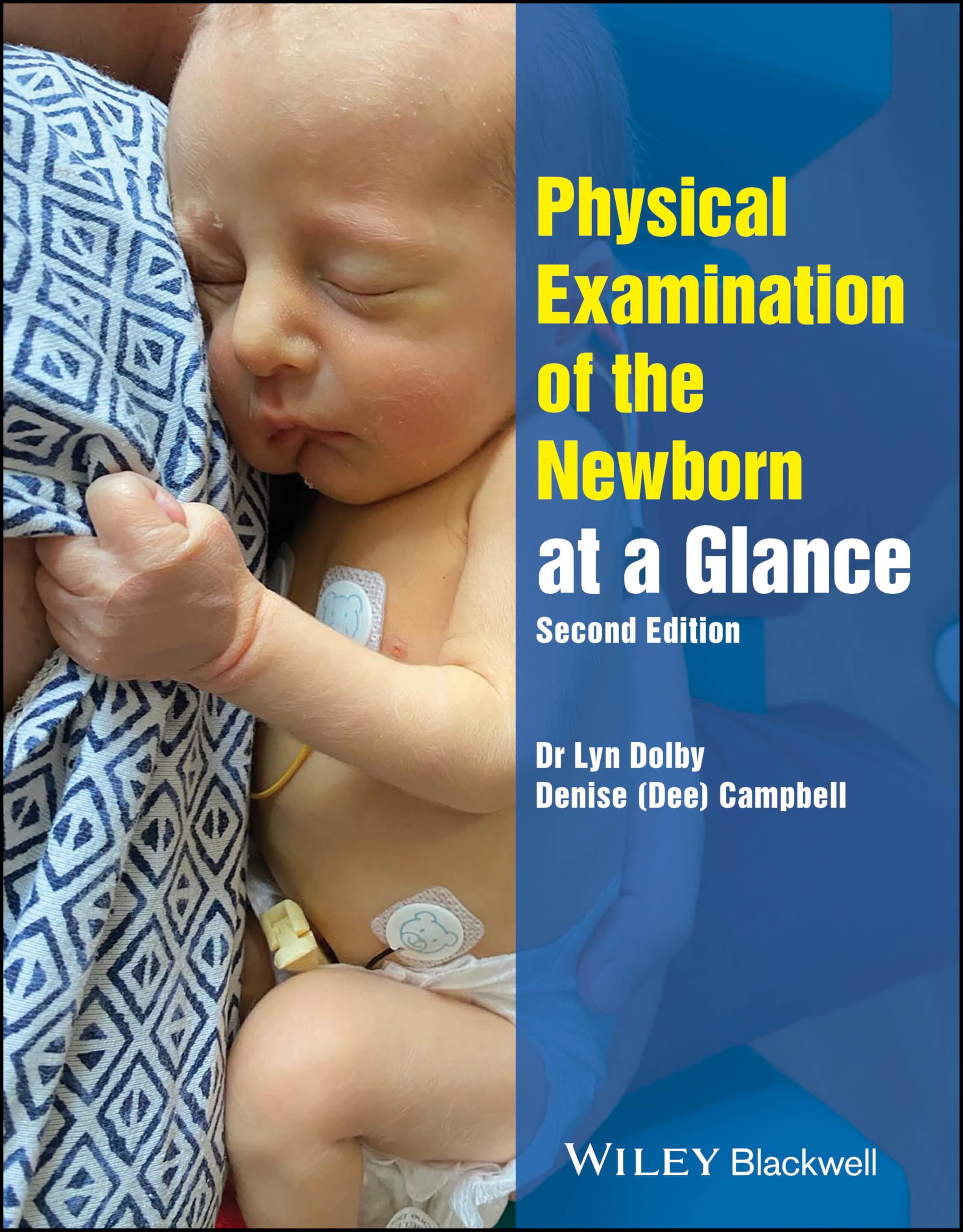 Physical Examination of the Newborn at a Glance by Lyn Dolby,... - 9781394277032