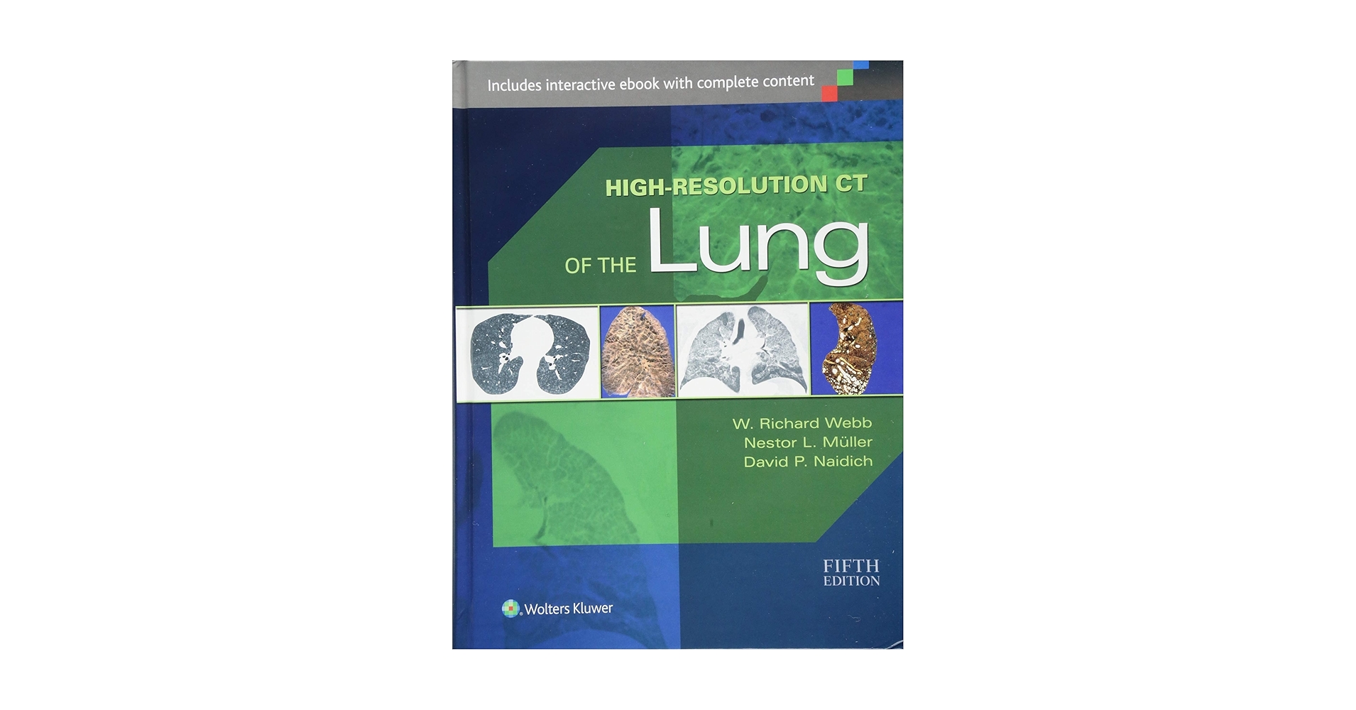 High-Resolution CT of the Lung 第5版 High-Resolution CT of the Lungs | AJR