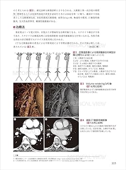腹部画像診断アトラスⅫ 腹部画像診断アトラスⅫ 腹部画像診断アトラス 1 | 長谷川 雄一