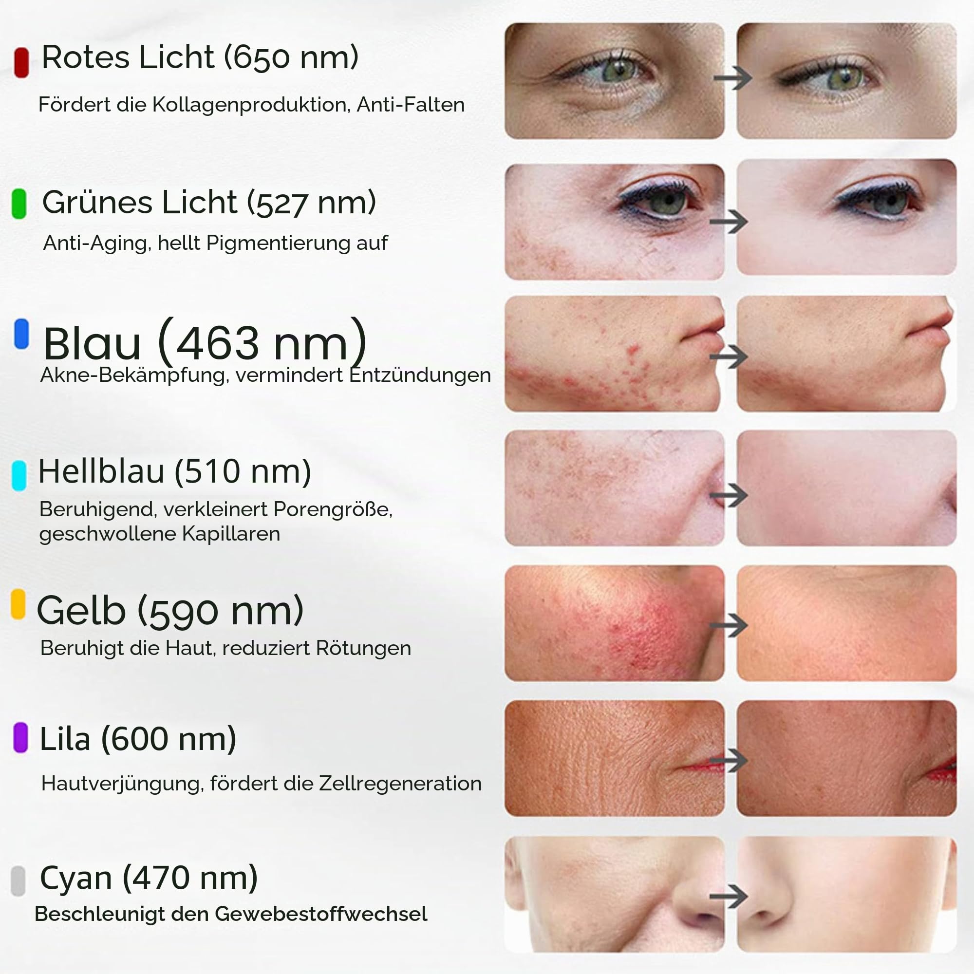 Lalano’S Cosmetics LED Gesichtsmaske 7 Farben – Anti-Aging, Akne & Hautstraffung – Lichttherapie, 112 LEDs, wiederaufladbar, CE-zertifiziert – Für Damen & Herren