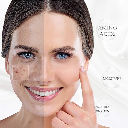 Miniatura 6 de HandSun funda de almohada de 100% seda morera para el cabello y la piel, en paquete de regalo, ambos lados de seda de 19momme, funda de almohada,