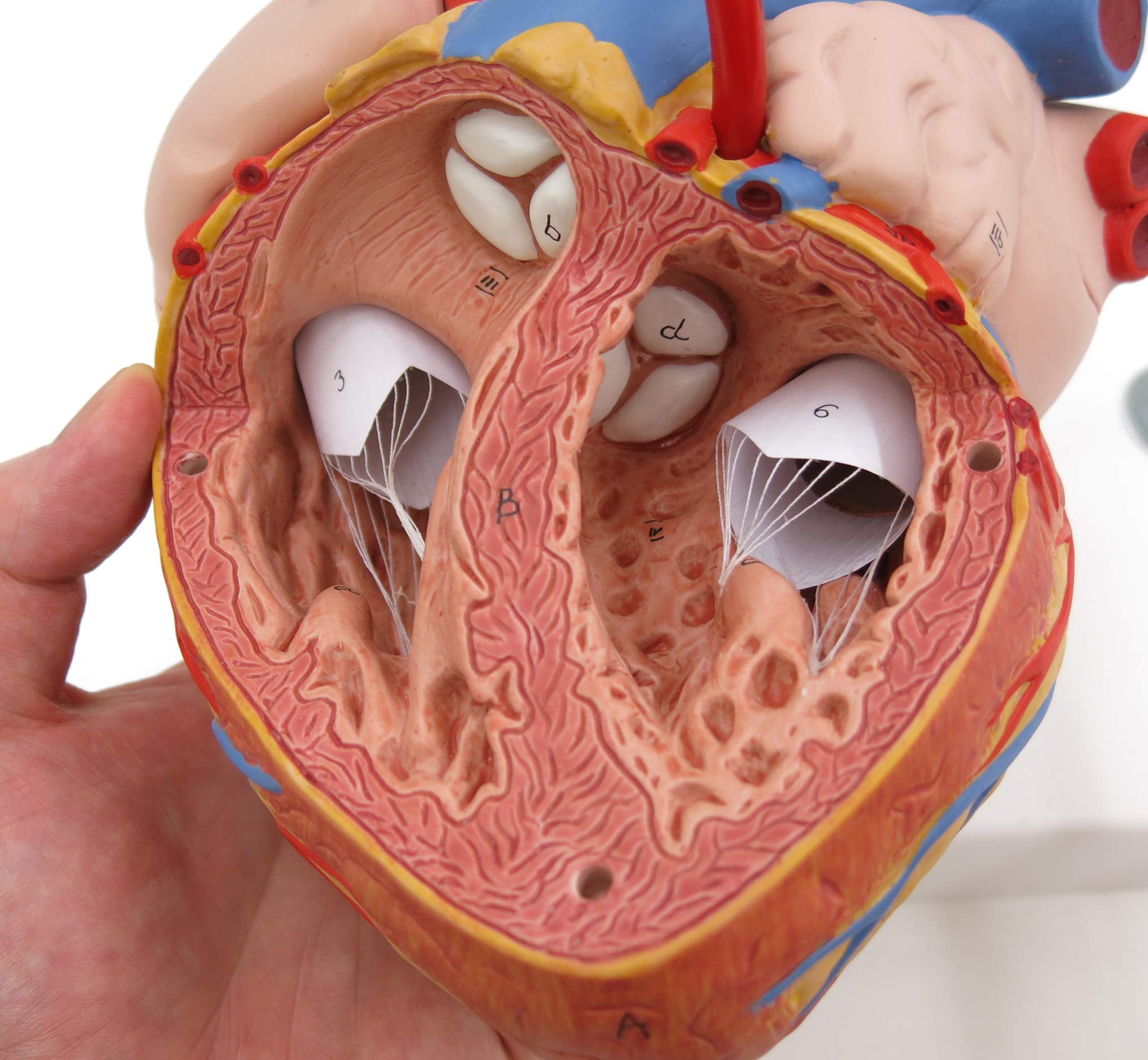 3B Scientific G06 Modello di Anatomia Umana Cuore con Bypass, Ingrandito 2 Volte, in 4 Parti + software gratuito di anatomia - 3B Smart Anatomy