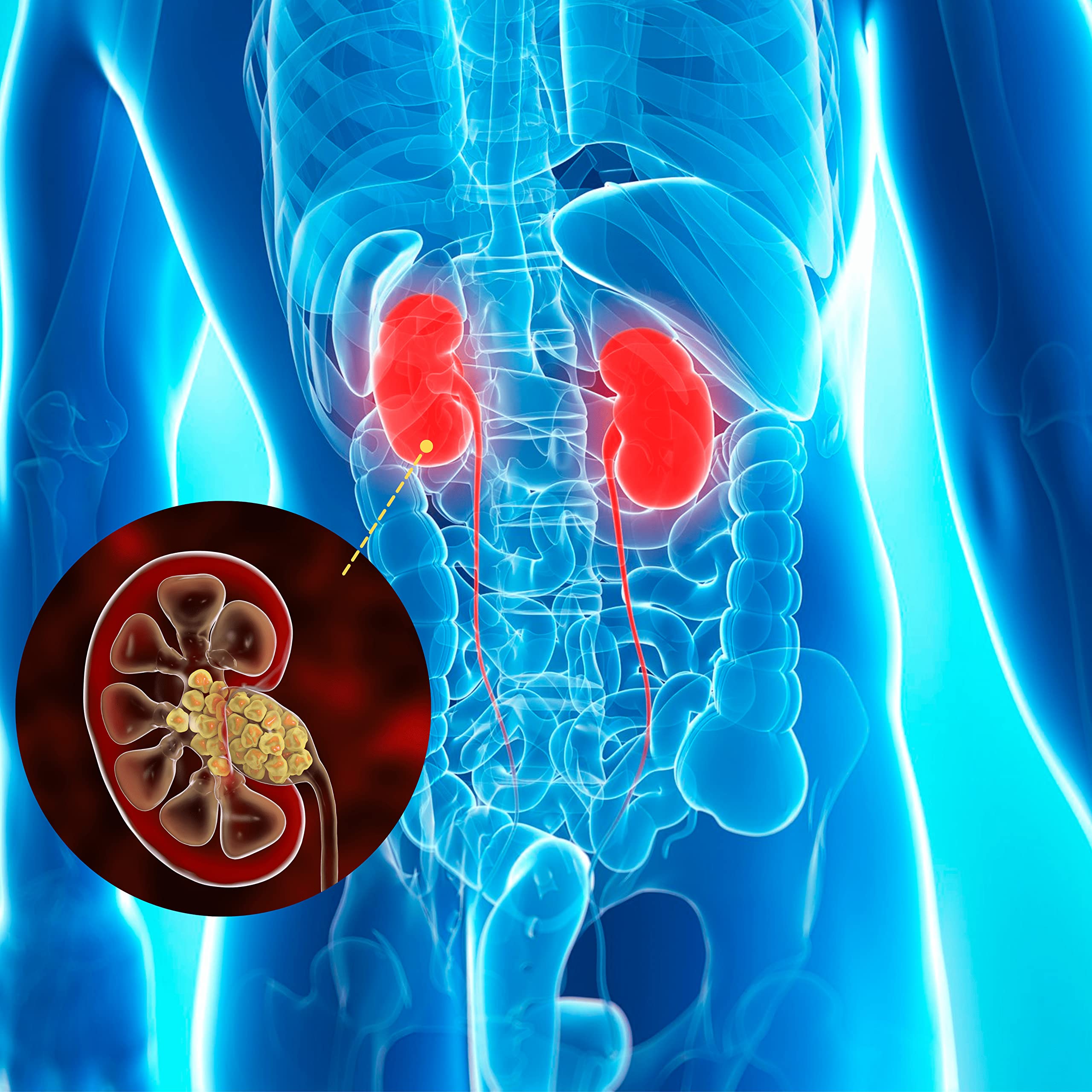 Svetical | Integratore che aiuta a prevenire la formazione e facilita l'espulsione dei Calcoli Renali | Con Spaccapietra, Mannosio e Cranberry | 30 Cpr