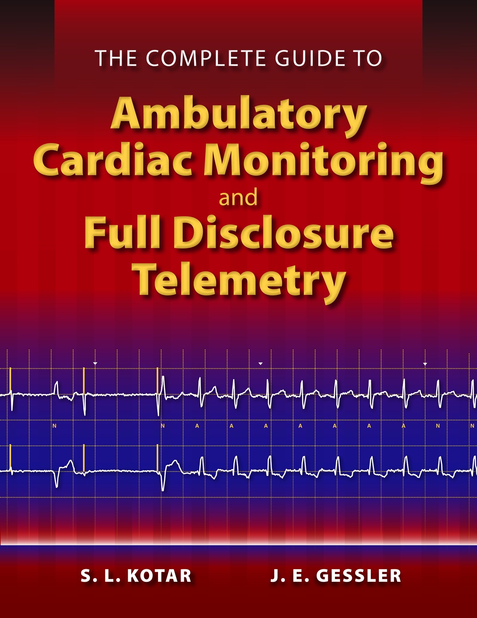 The Complete Guide to Ambulatory Cardiac Monitoring and Full Disclosure Telemetry