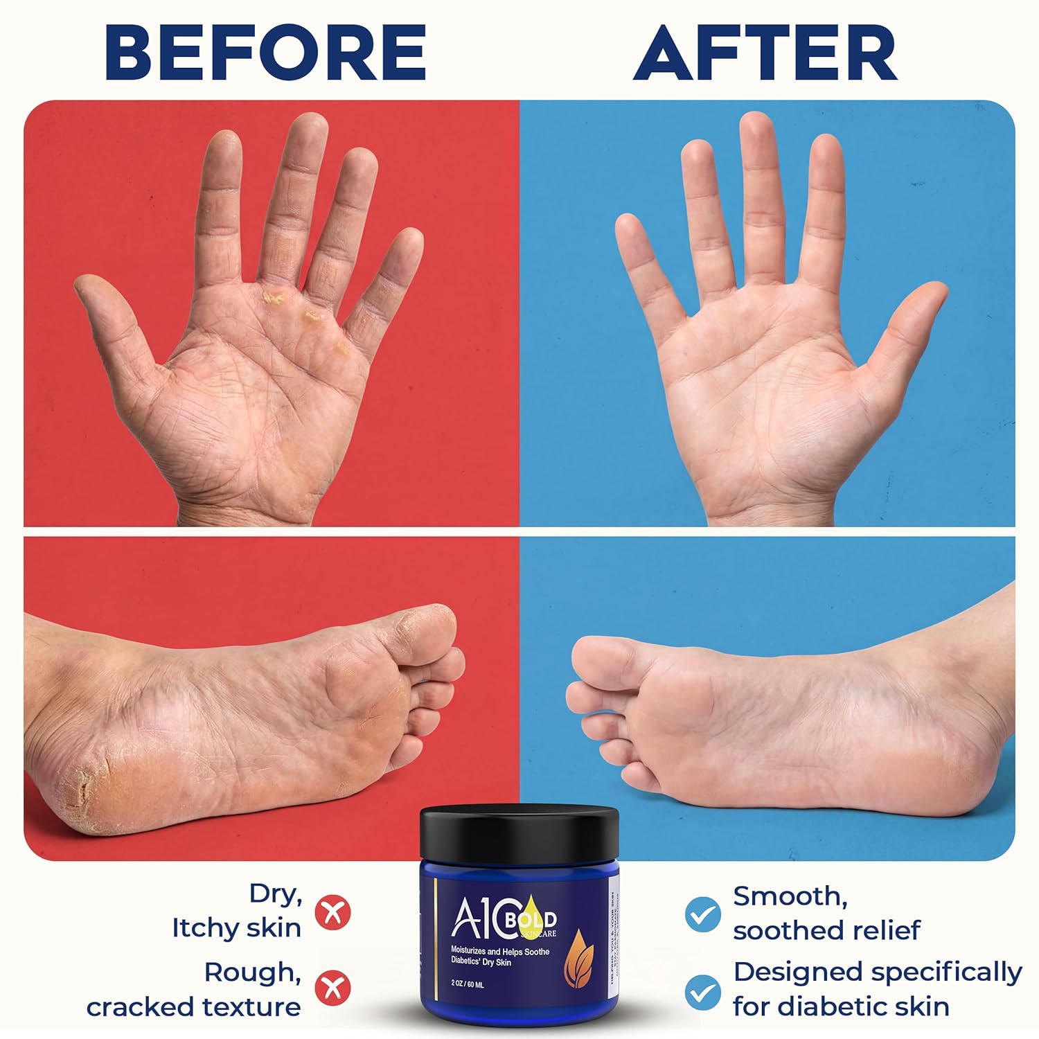 Diabetic Care Balm - Balm for Diabetics Care with Beeswax & Vitamin E, Diabetic Moisturizer For Dry, Cracked Hands & Feet, Long-Lasting Hydration for Sensitive Skin, 2 oz - Image 5