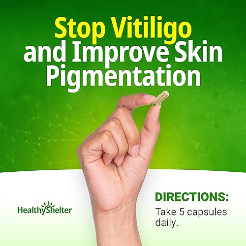 Miniatura 2 de Di adiós al vitíligo y a las manchas blancas en la piel con un tratamiento eficaz de pigmentación de la piel Seronex. Úselo con cremas de