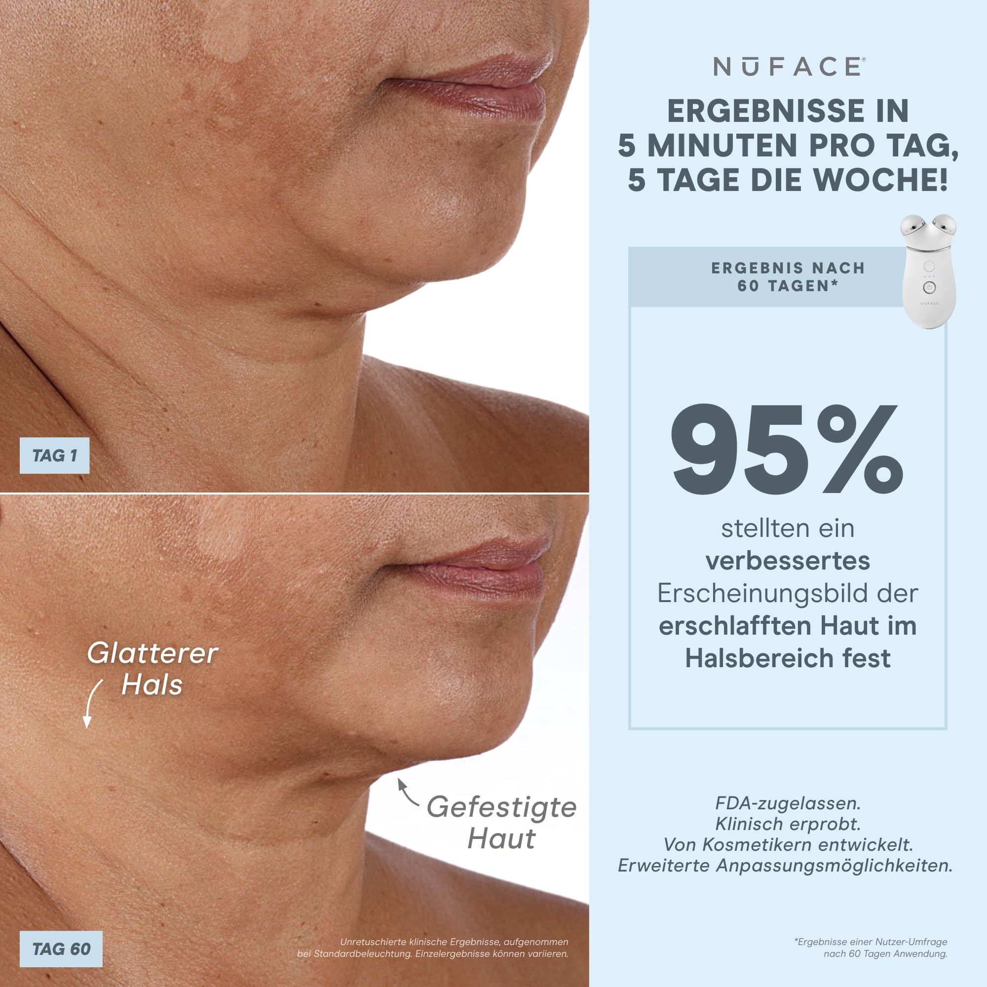 NuFACE TRINITY+ Lip & Eye Attachment