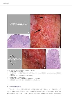 裁断済み　アトラスでみる外陰部疾患 プライベートパーツの診かた アトラスでみる外陰部疾患: プライベートパーツの診かた | 尾上