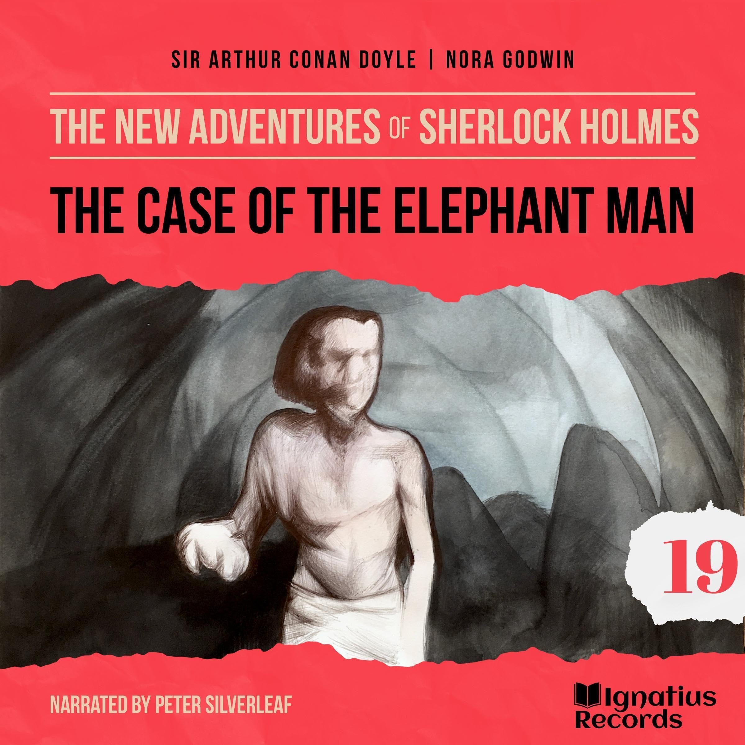 The Case of the Elephant Man