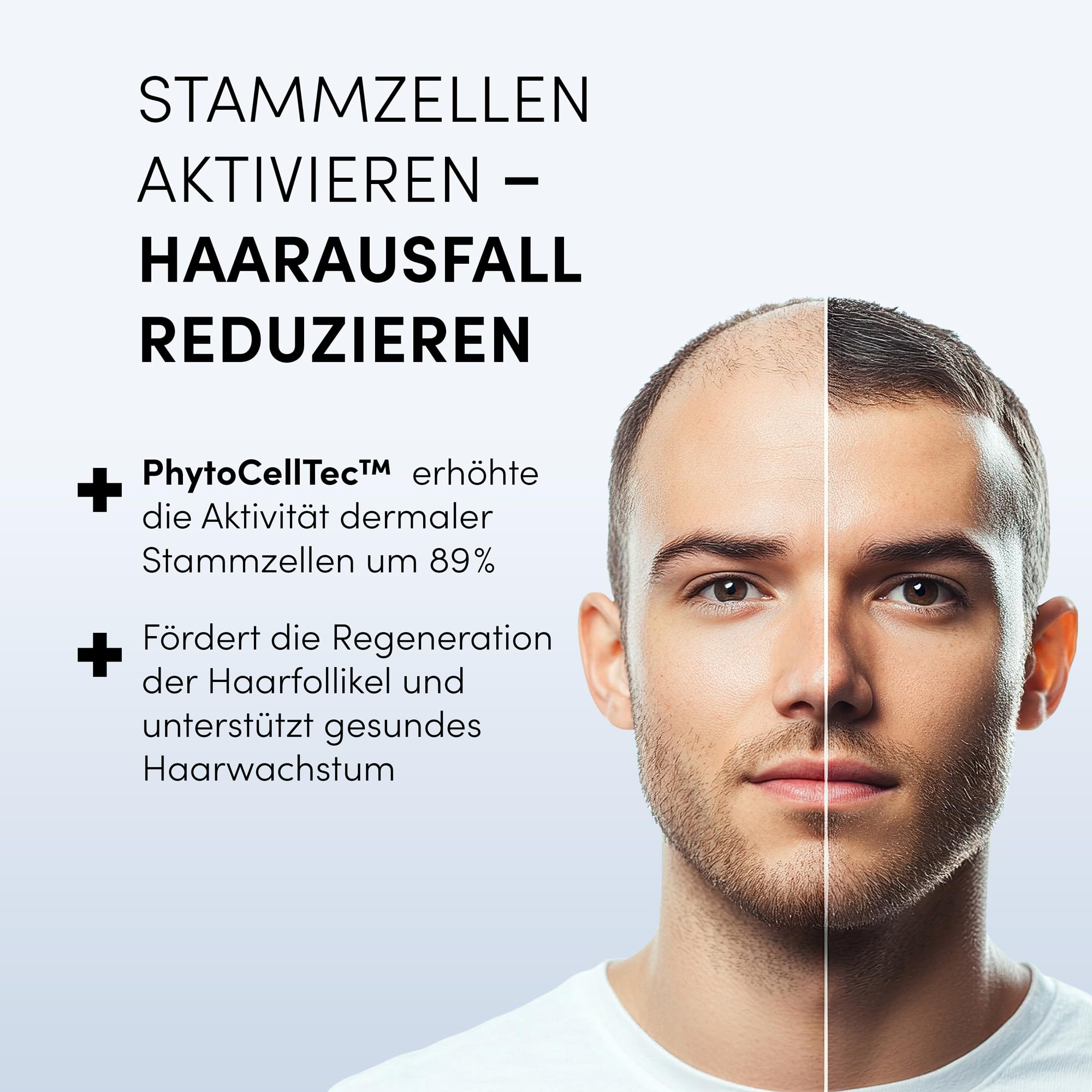 Dr. Balwi Anti-Haarausfall Serum mit Procapil & AnaGain, stärkt Haarwurzeln, fördert Haarwachstum, mit Biotin & Stammzellen, ohne Silikone & Parabene, 5x6ml Flacon