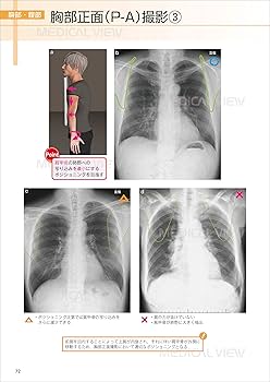 268 ブラケットポジショニング 実践と臨床 268 ブラケットポジショニング 実践と臨床