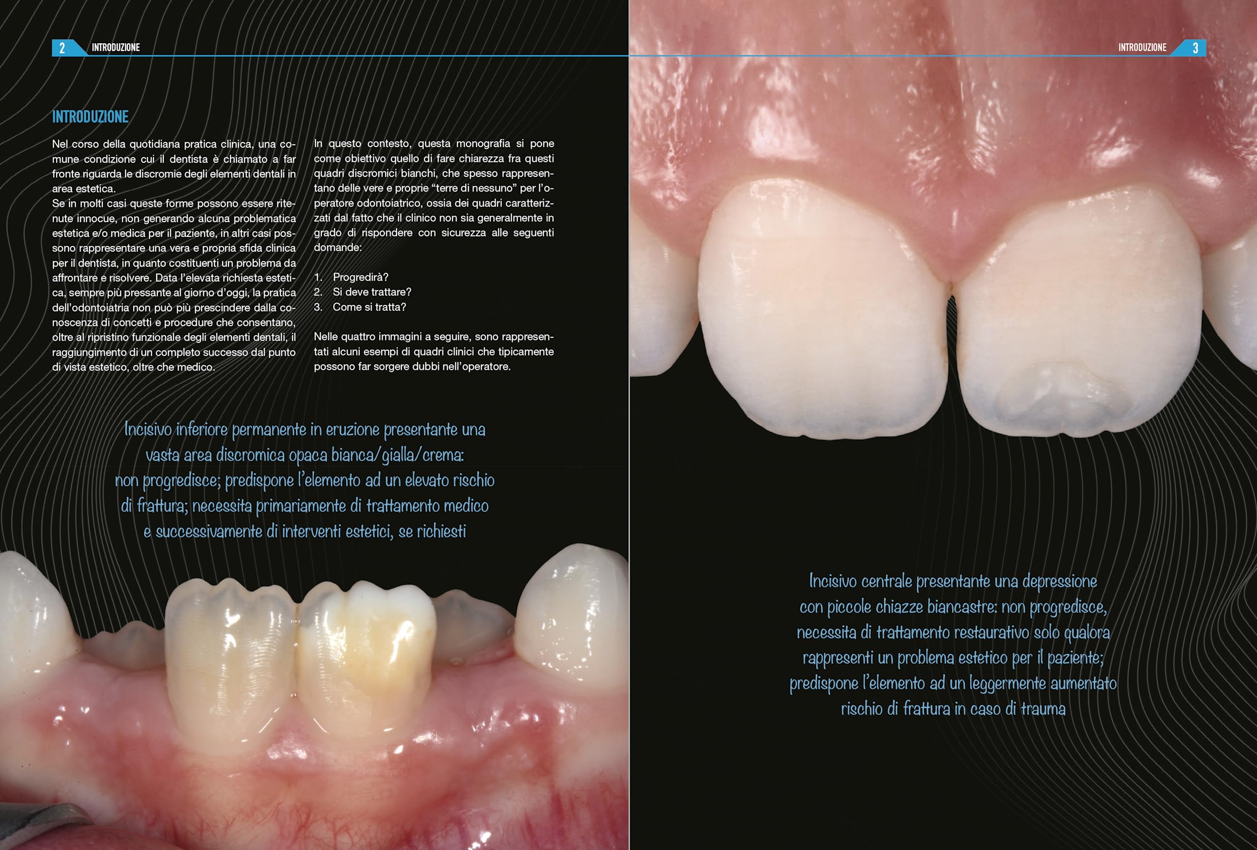 Diagnosi e trattamento delle lesioni bianche in area estetica. Manuale clinico operativo