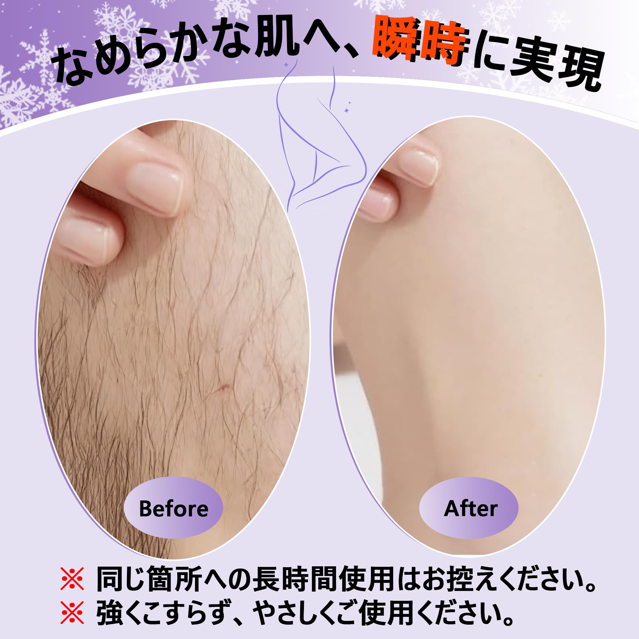 Amazon.co.jp: 脱毛器 擦るだけ 【2026業界の技術革新】 無痛脱毛器