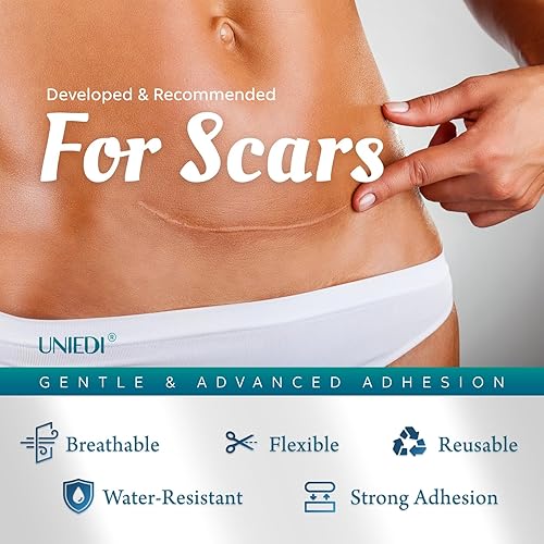Miniatura 3 de Hojas de silicona para cicatrices, cinta de silicona para cicatrices (rollo de 1.6 x 120 pulgadas - 9.8 ft), cinta de cicatriz para cicatrices