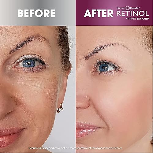 Miniatura 4 de Retinol LIVAURA Crema de noche y crema de día enriquecida con vitaminas, tu dúo de cuidado de la piel de 24 horas que trabaja día y noche para darte