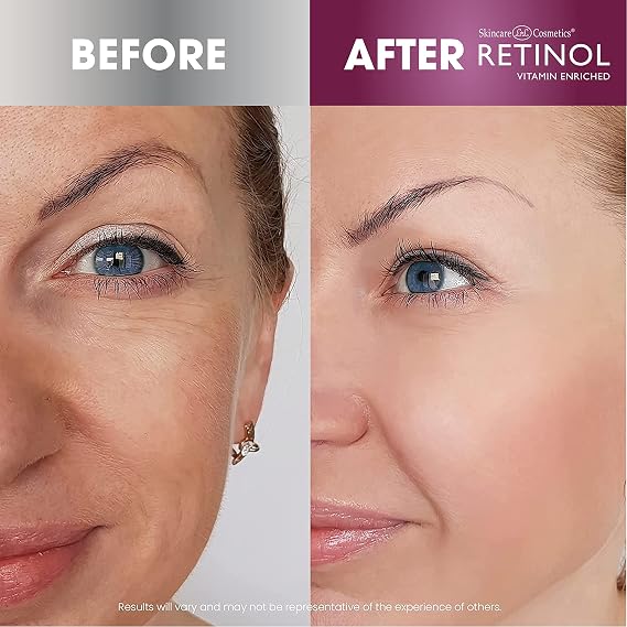 Retinol Super Face Lift - Visibly firms and tightens for a lifted, younger look. Infused, with Vitamins C & E + Retinol Night Cream Works While You Sleep to Restore and Reduce Fine Lines and Wrinkle