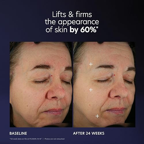 Miniatura 10 de PCA SKIN Pro Max Age Renewal - Suero antienvejecimiento antienvejecimiento para reducir las arrugas y la flacidez de la piel, ayuda a levantar y