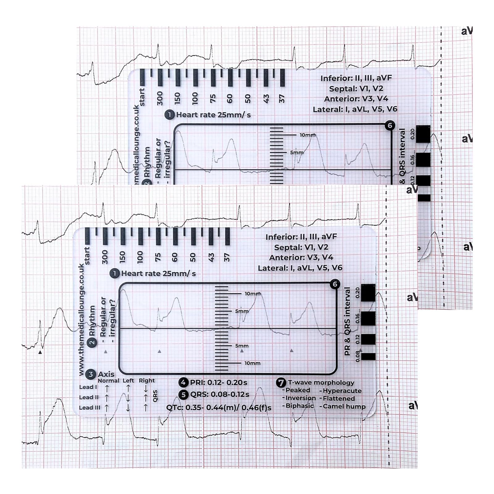 2 Pcs Ecg 7 Step Ruler, Ecg Ruler Card, Portable Ecg Ruler Pocket Card ...