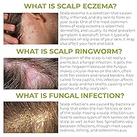 Vista 3 de Champú para foliculitis Champú antifúngico para dermatitis seborreica, psoriasis del cuero cabelludo y caspa Alivia la picazón y el cuero