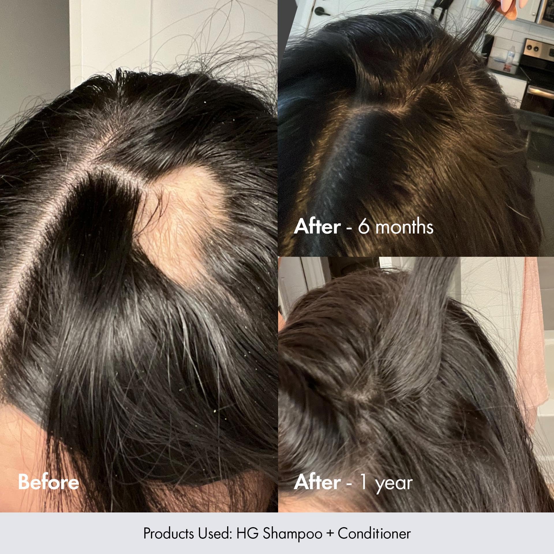 BONDIBOOST HG Anti-Thinning Hair Conditioner