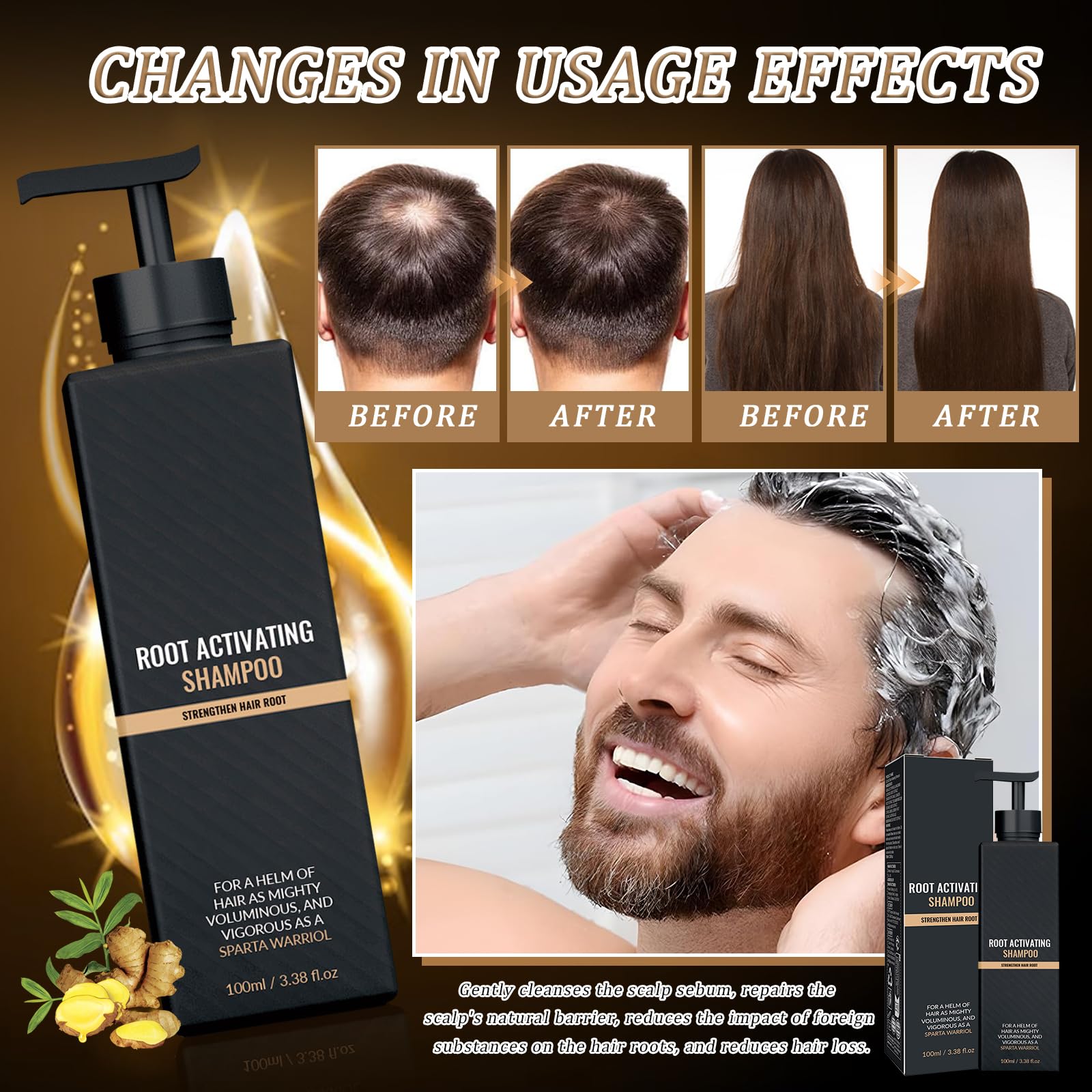 Spart Root Activator Shampoo 2 Piezas Champú Activador de Raíces Ingredientes Botánicos Suaves