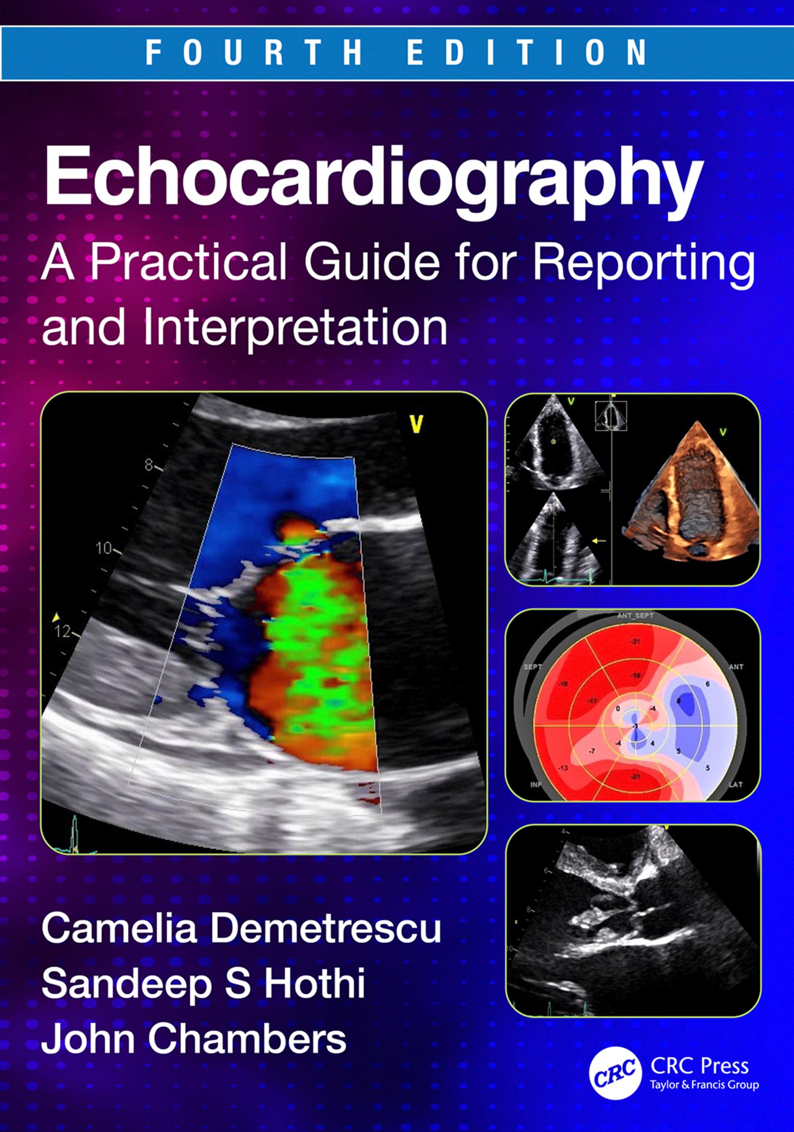 Echocardiography: A Practical Guide for Reporting and Interpretation (English Edition)
