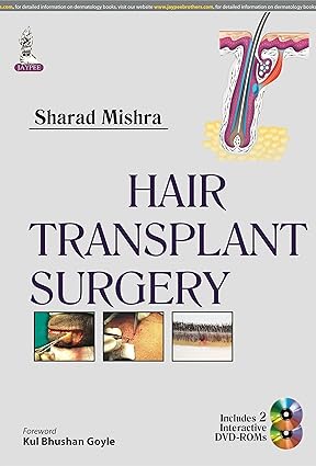 HAIR TRANSPLANT SURGERY
