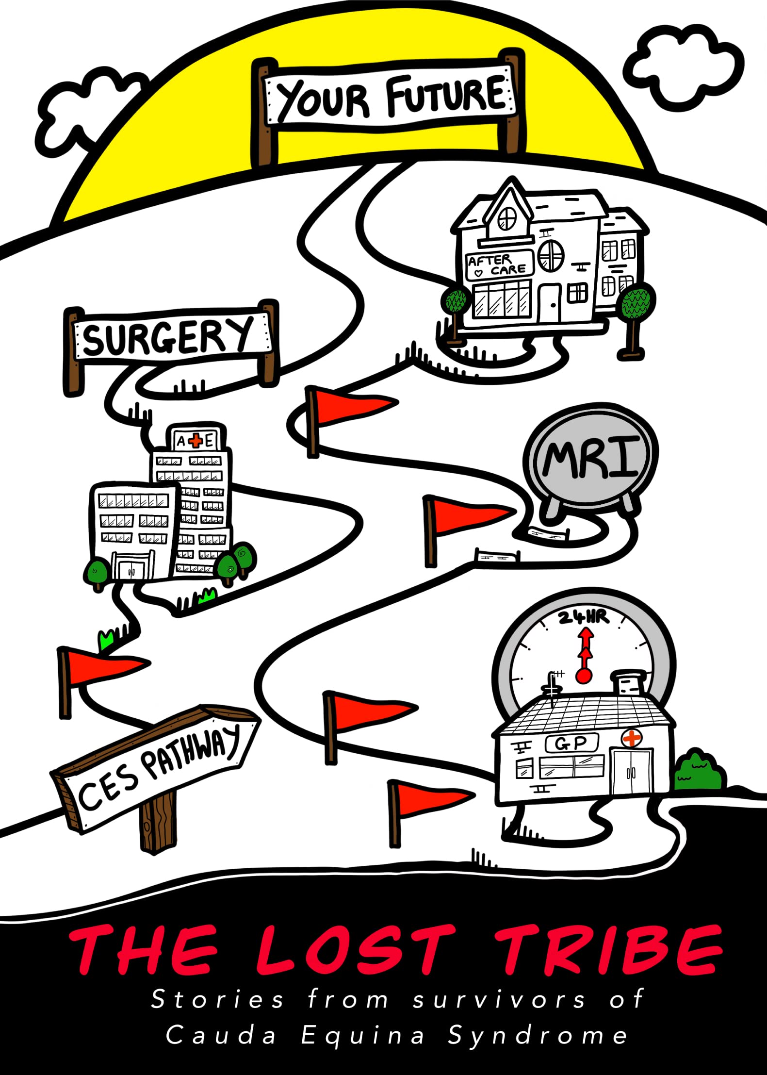 The Lost Tribe: Stories from Survivors of Cauda Equina Syndrome