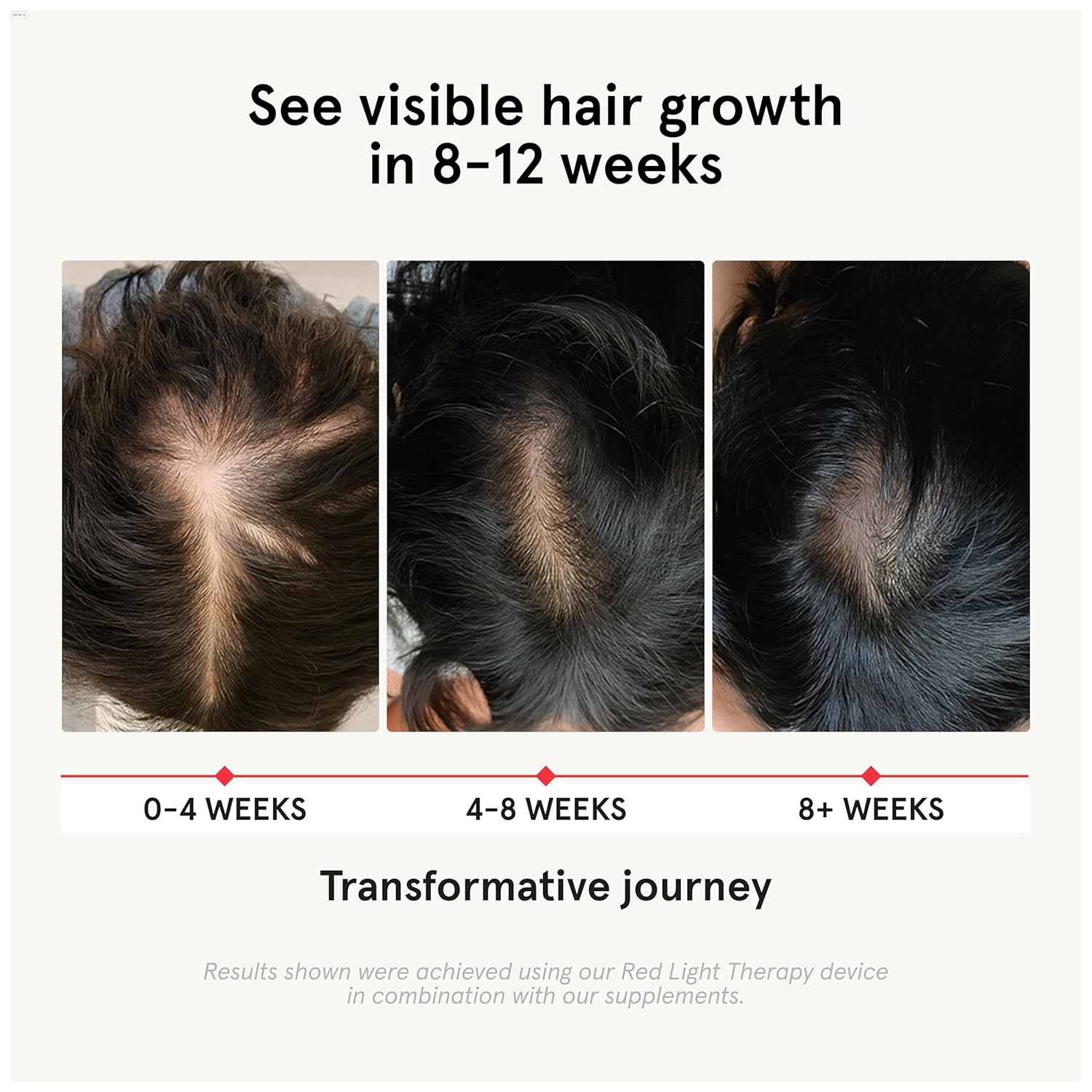 iRestore Hair Growth Supplement - Hair Loss Vitamins for Women and Men - Biotin Multivitamins & DHT Blocker to Reduce Hair Thinning - Hair Regrowth Pills - 30 Days Supply 90 Count (Pack of 1) - Image 2