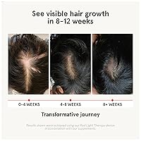 Vista 2 de iRestore Suplemento para el crecimiento del cabello, vitaminas para la pérdida del cabello para mujeres y hombres, multivitaminas de biotina