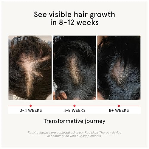 Miniatura 2 de iRestore Suplemento para el crecimiento del cabello, vitaminas para la pérdida del cabello para mujeres y hombres, multivitaminas de biotina