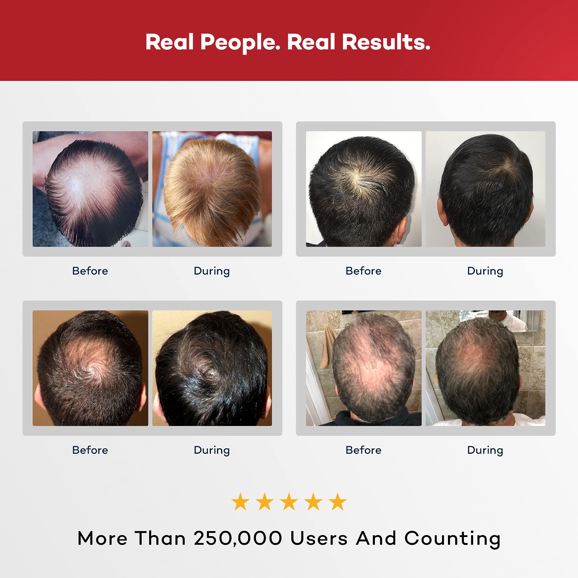 Buy REX MD Hair Loss Vegan Shampoo for Men, DHT Defense Formula Helps