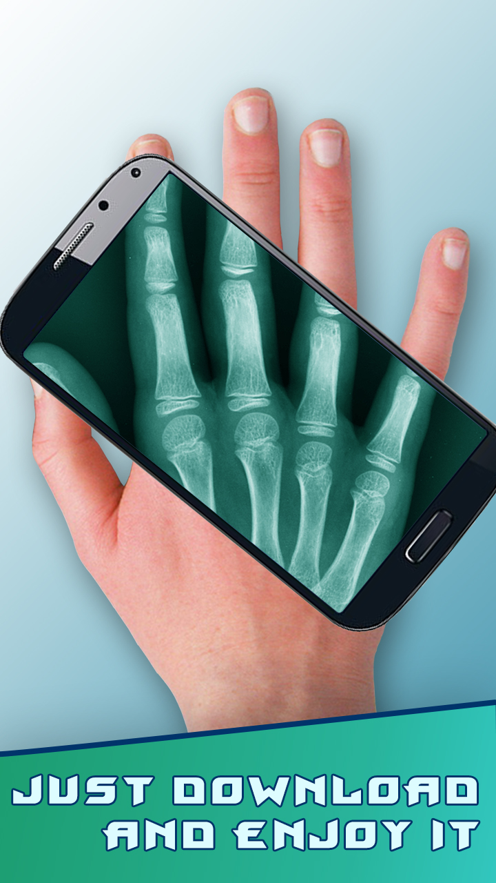 Amazing XRayAmazon.co.jpAppstore for Android