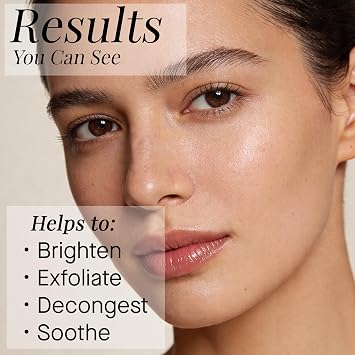 ARCONA Gentle Solution Serum Exfoliant - 4% Glycolic, 3% Lactic Acids, Algae, Witch Hazel + Honeysuckle Gently Exfoliate + Hydrate Skin 1.17oz. Made In The USA