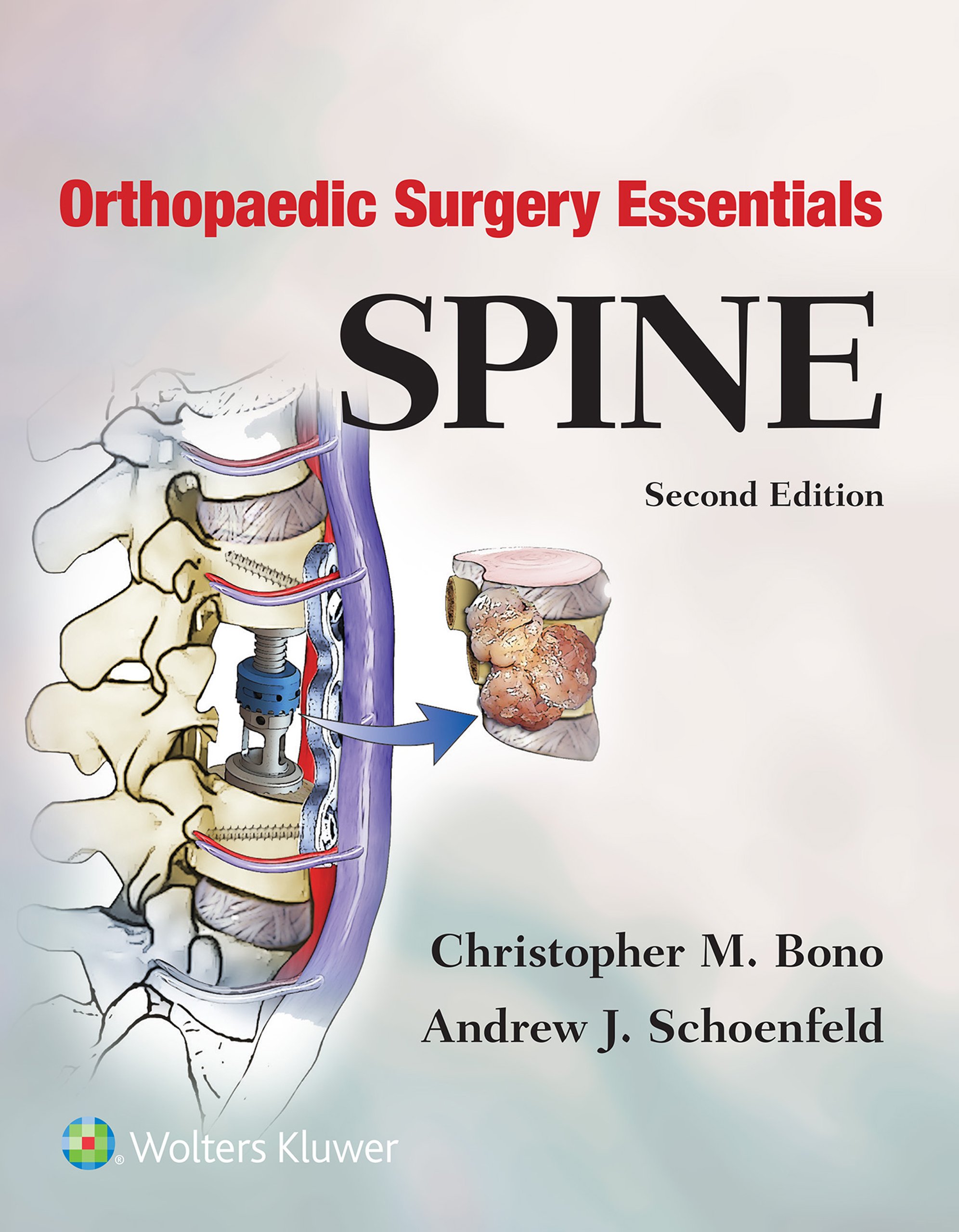 Orthopaedic Surgery Essentials: Spine (Orthopaedic Surgery Essentials Series)