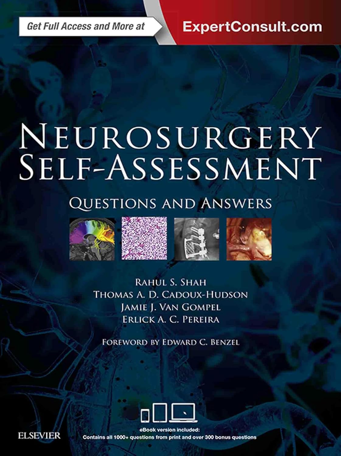 Neurosurgery Self-Assessment E-Book: Questions and Answers