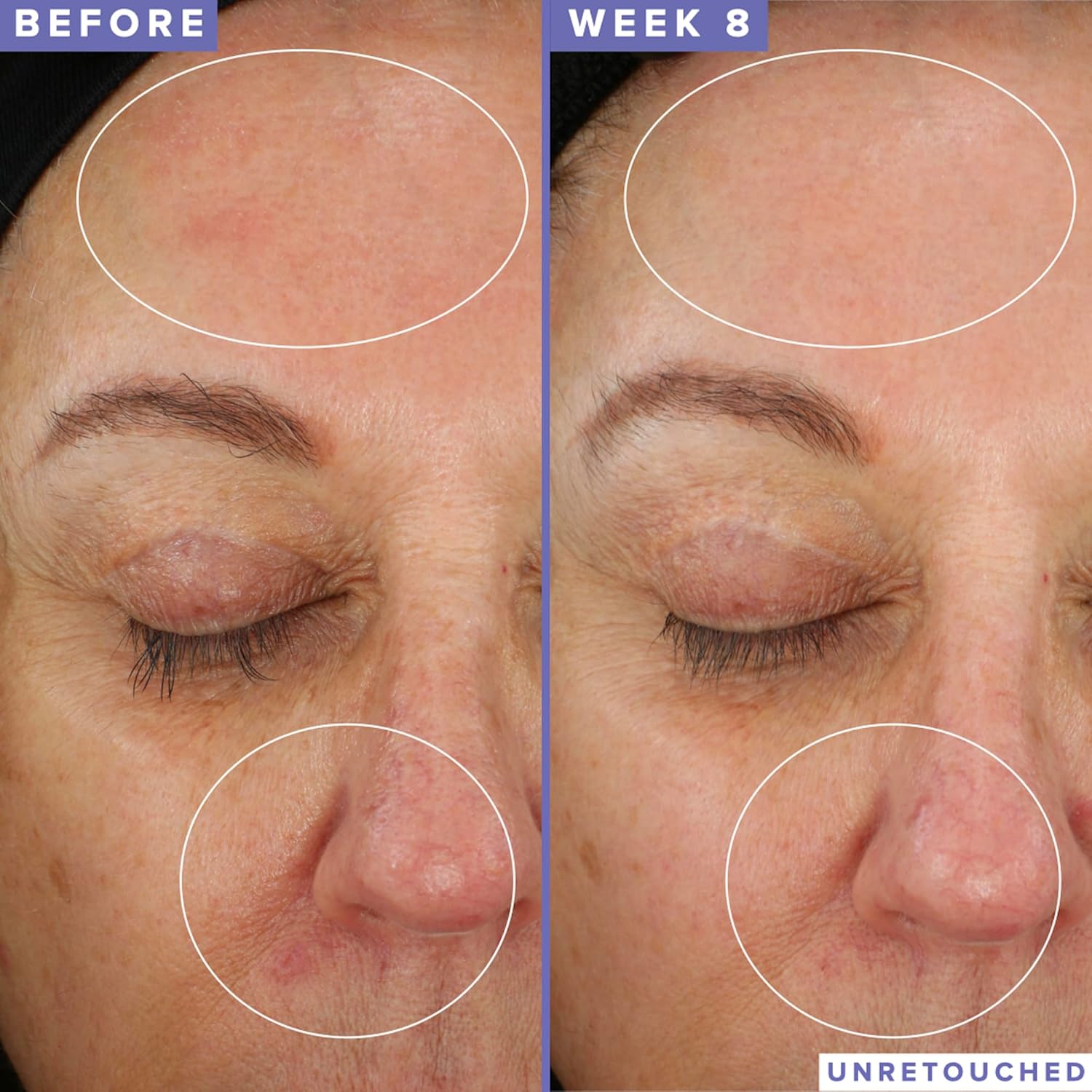 Farmacy Niacinamide Overnight Face Mask - Pore Refining Facial Mask with 10% Niacinamide - Replenishes Moisture Barrier with 3% Panthenol + Blueberry Seed Oil for Soft, Supple Skin (50ml) 48 g (Pack of 1) image 4 of 9 B09TV9KCSH