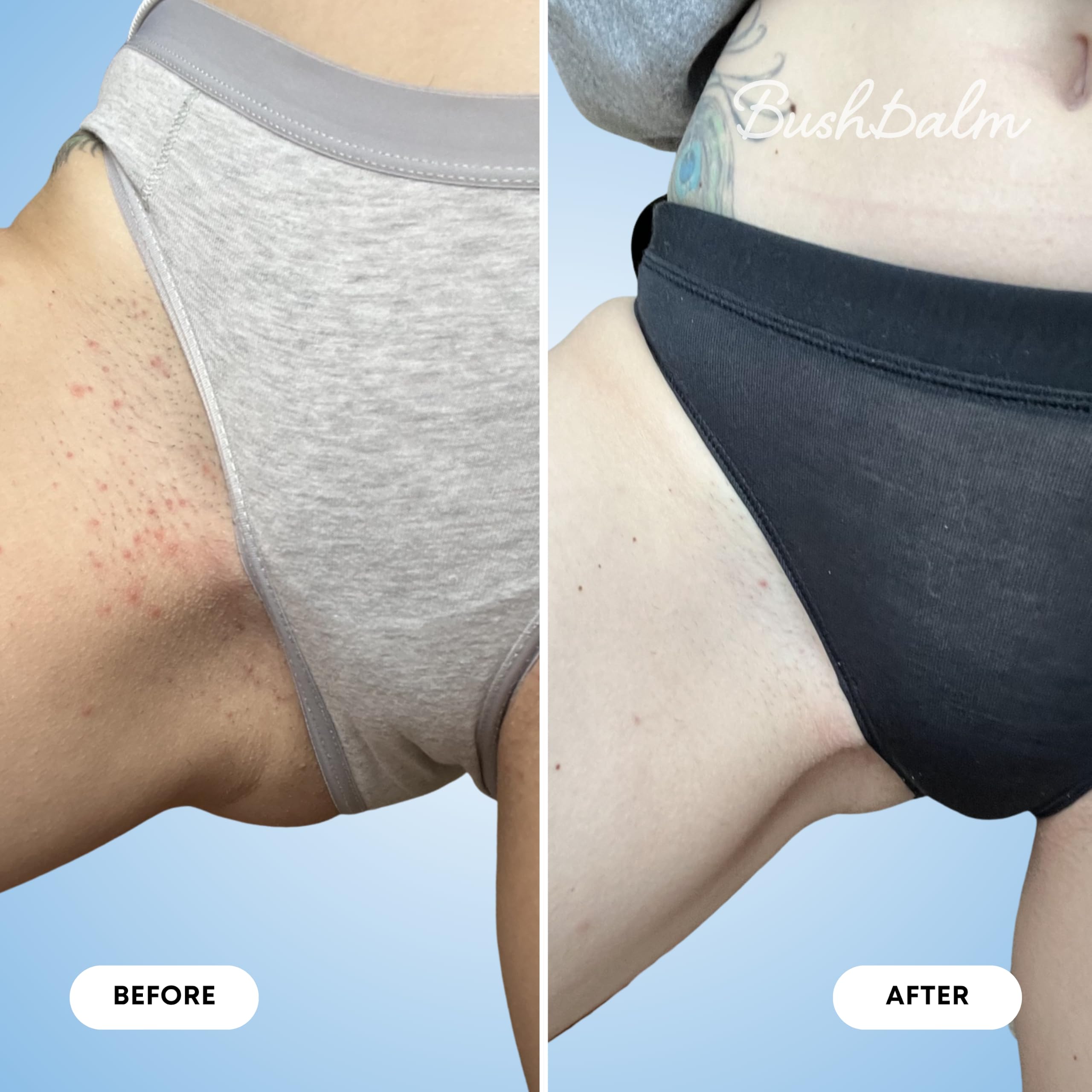 Bushbalm Peeling do wrastających włosów, peeling cukrowy przed goleniem do wrastających włosów, podrażnienia golenia i suchej skóry, zmiękcza i koi wrażliwą skórę, kolor gniazda, 230 ml