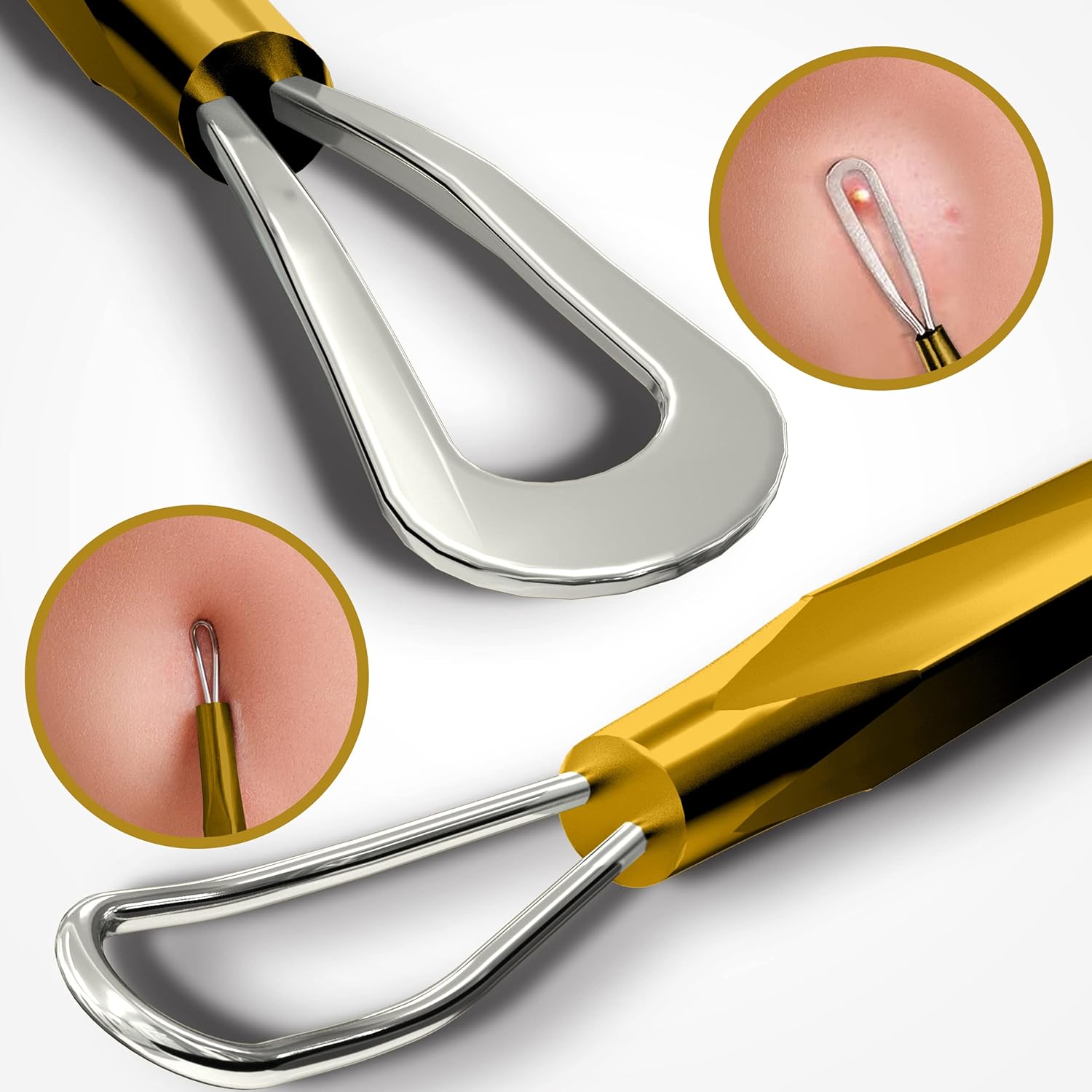 Big Blackheads: What To Expect From Professional Extractions - jwcrkz8