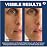 L\'Oreal Paris Revitalift 0.3% Pure Retinol Night Serum, Reduce Deep Wrinkles, Fragrance Free 1 oz + Moisturizer Sample