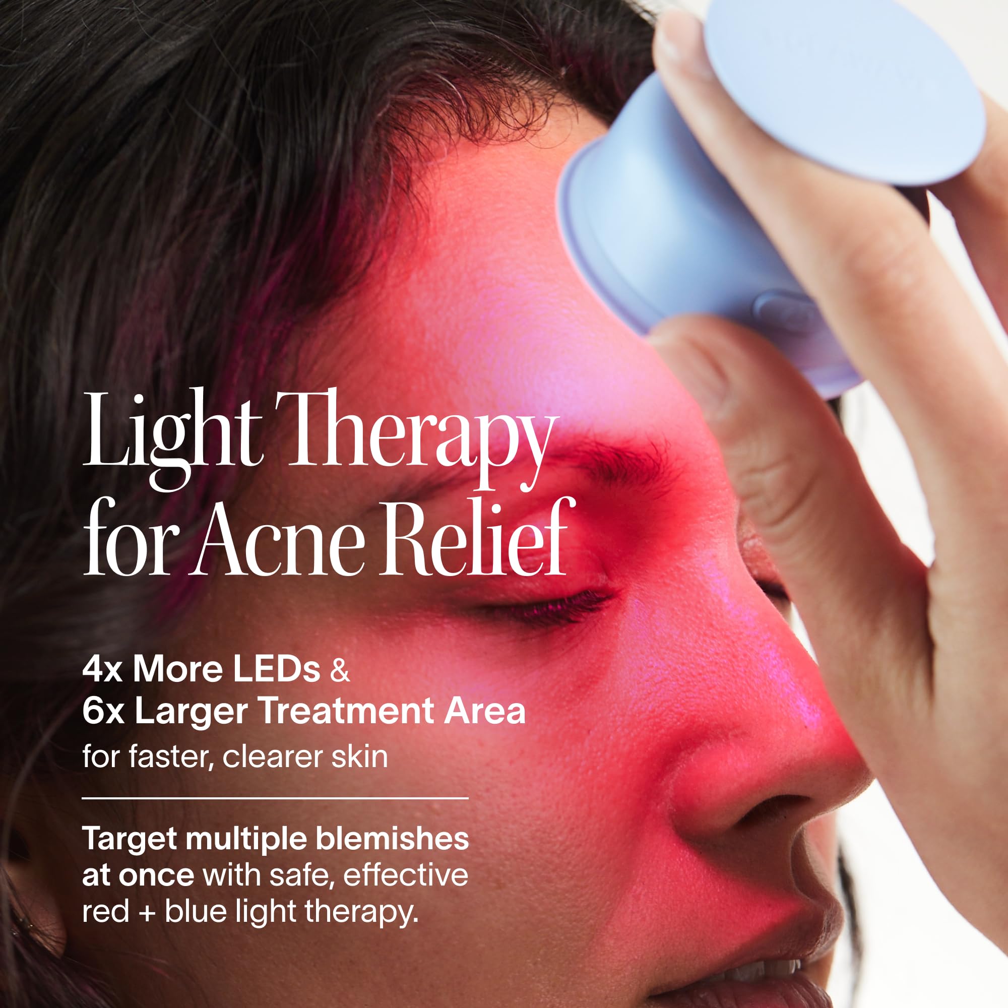 Solawave Bye Acne - FDA-Cleared Blue & Red Light Therapy for Face & Body | LED face wand helps reduce redness pimples zits & blemishes. Non-invasive painless 3-min use prevents future breakou product thumbnail 4