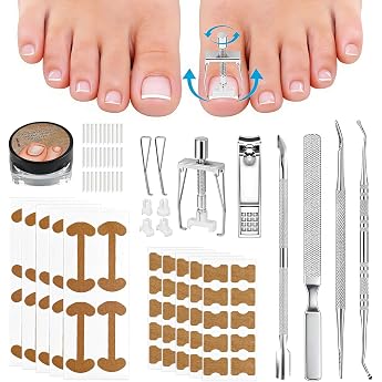 Eingewachsene Zehenn gel Werkzeug Set 112 St ck Zehennagel Korrektur Set