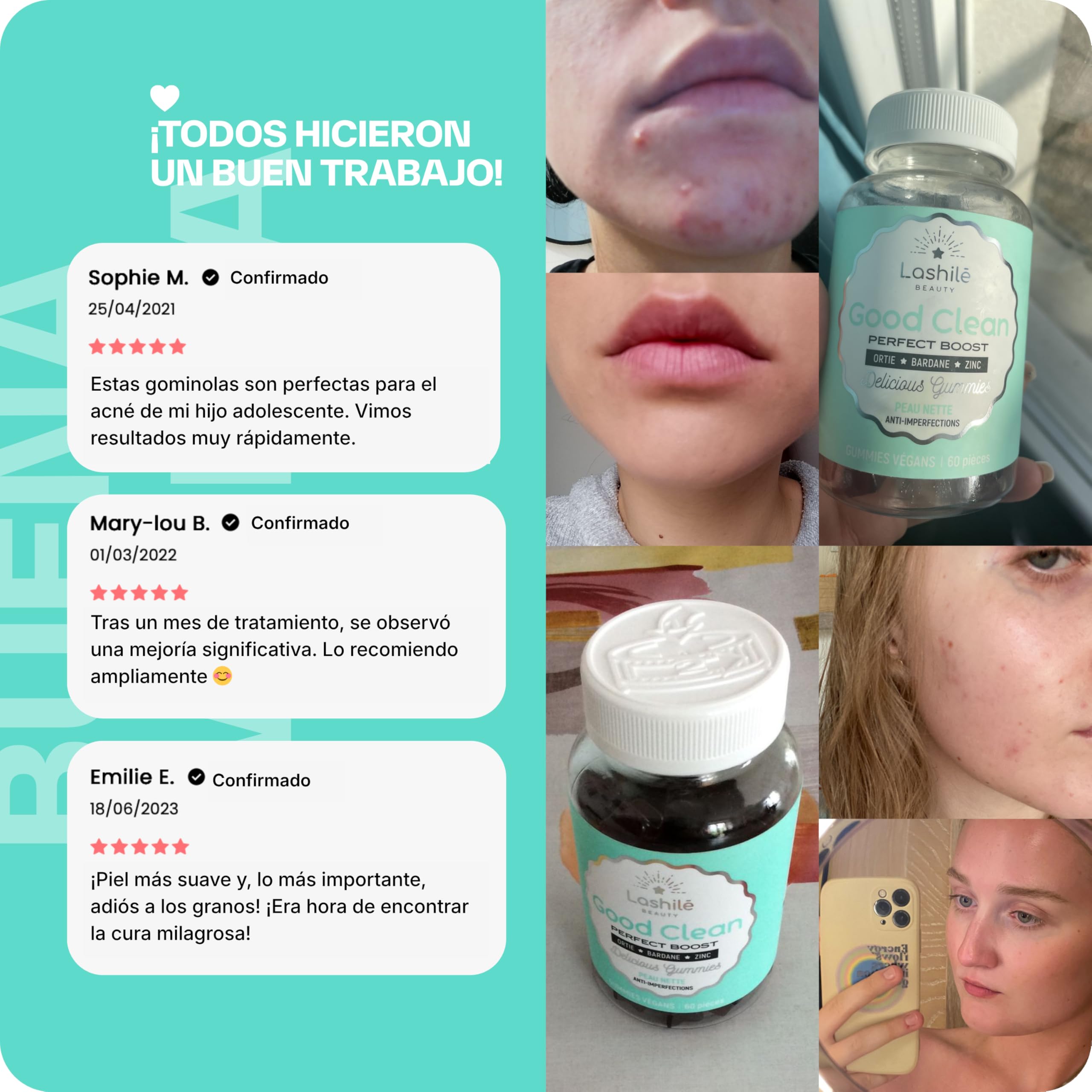 Lashilé Beauty - Complementos Alimenticios - Piel limpia y antiimperfecciones - Regula el sebo y purifica - Good Clean Vitamines - Fabricado en Francia - Bardana, Ortiga, Zinc - 180 Gummies