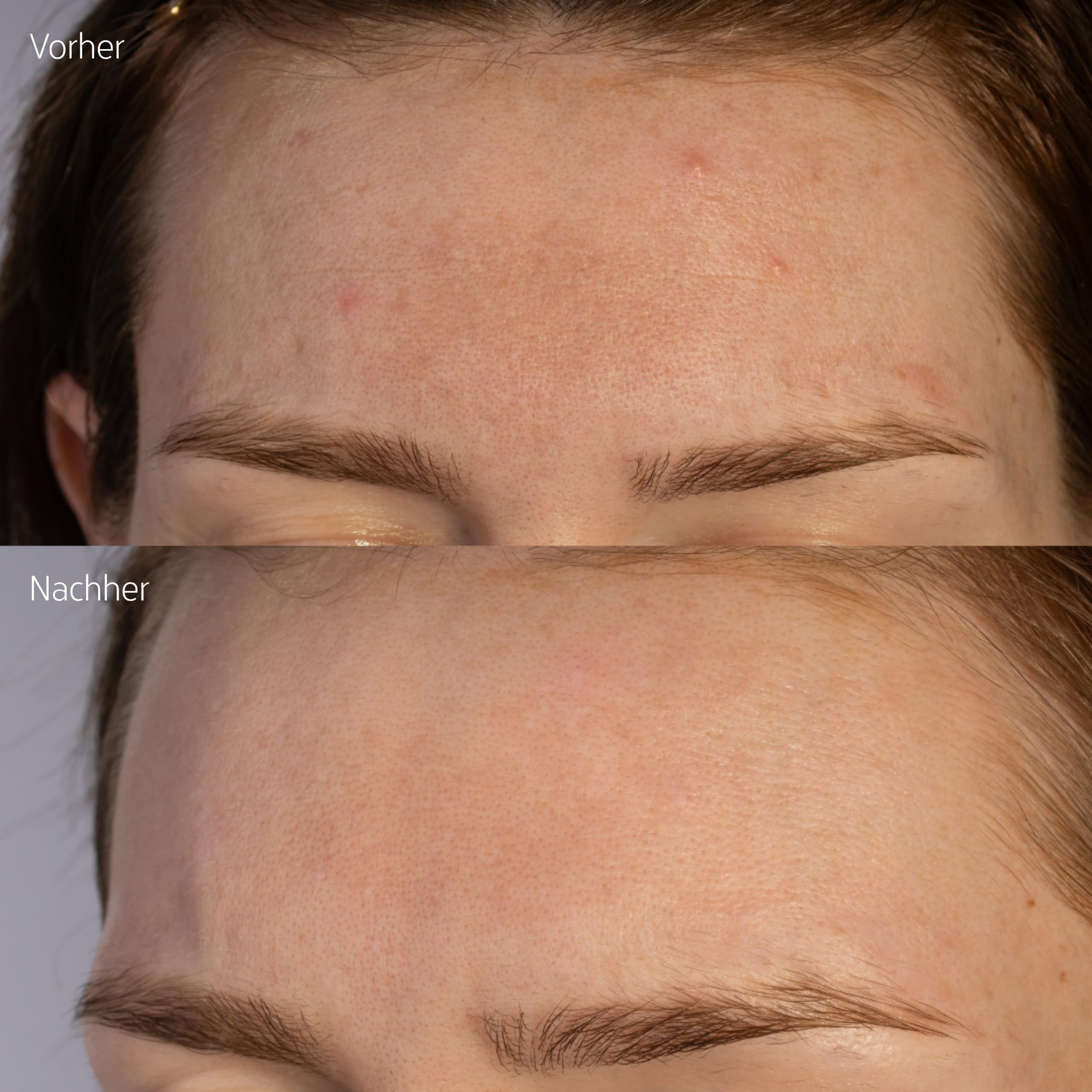 Retinal-In Serum – Pro-Aging Nachtserum mit Retinal, Niacinamid, Ceramiden & Hafer-Extrakt – Für glattere, gestärkte Haut – 30 ml