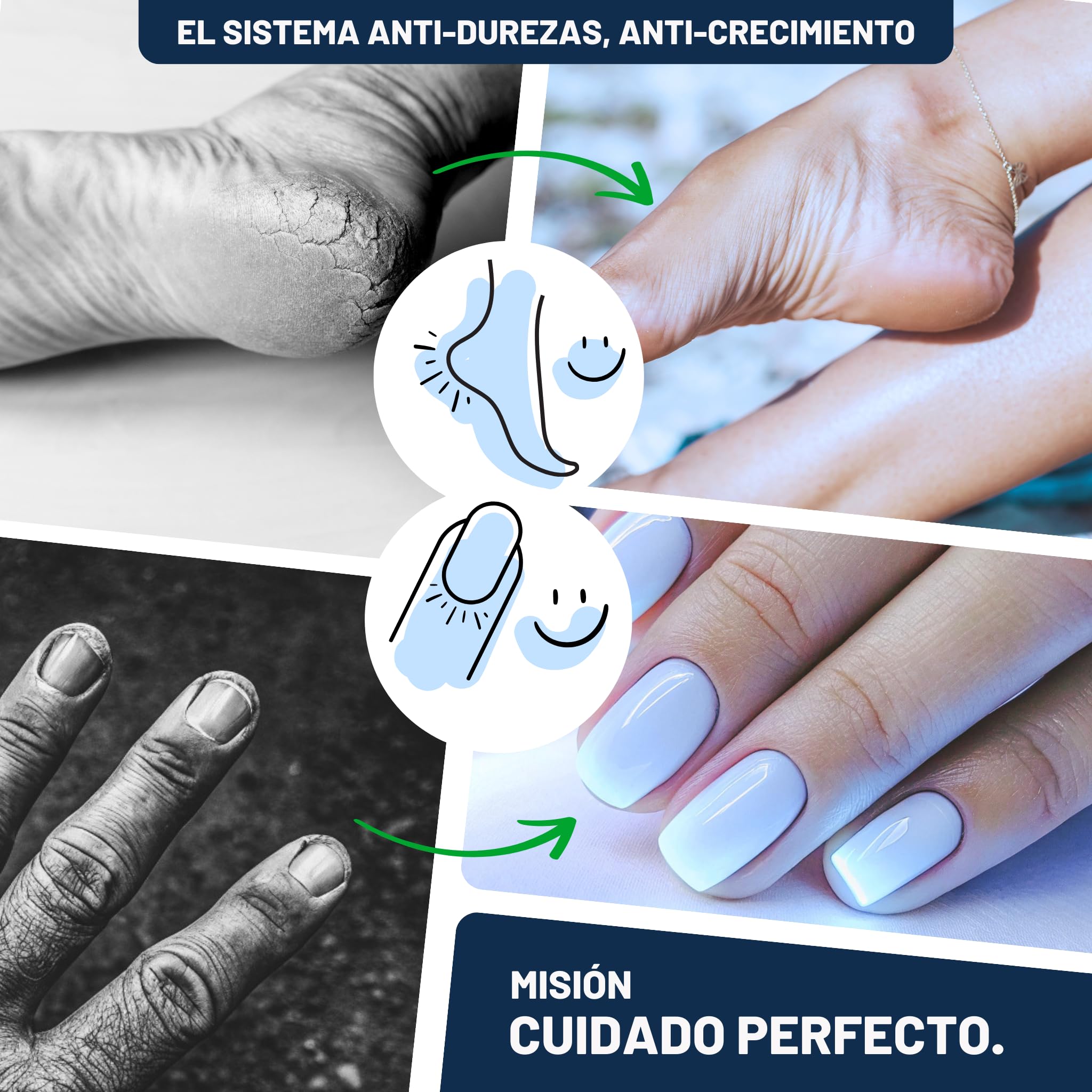 Mr. Fuss Solución Removedor de Durezas - Elimina Fácilmente Callos - Suave y Rápido - 250ml No. 4 en el Paquete Plus. Set de Pedicura sin Frotar con Efecto Inmediato.