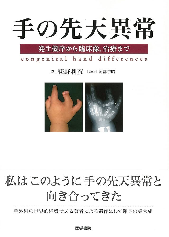 手の先天異常: 発生機序から臨床像,治療まで | 荻野 利彦 |本