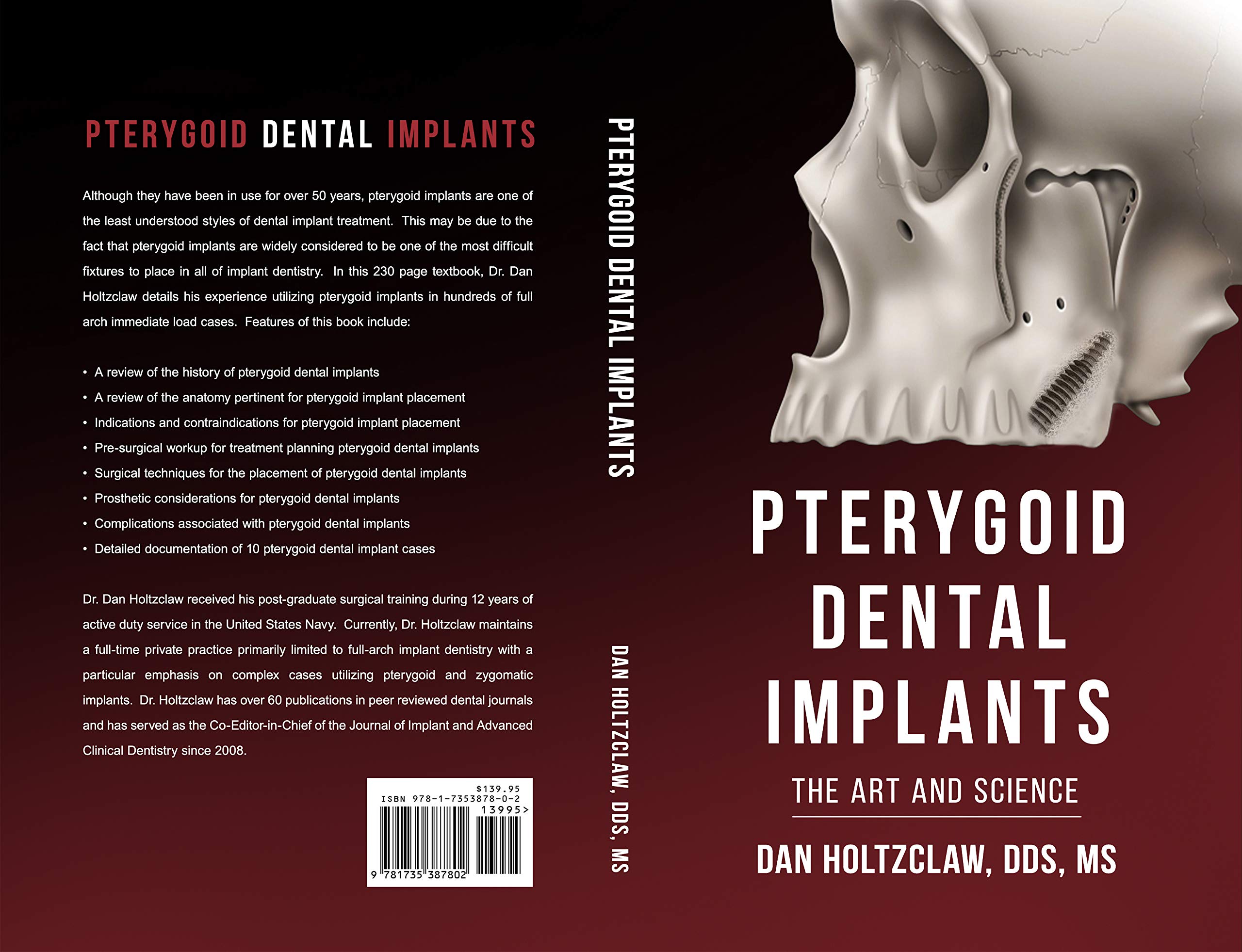Pterygoid Implants: The Art and Science product thumbnail 3