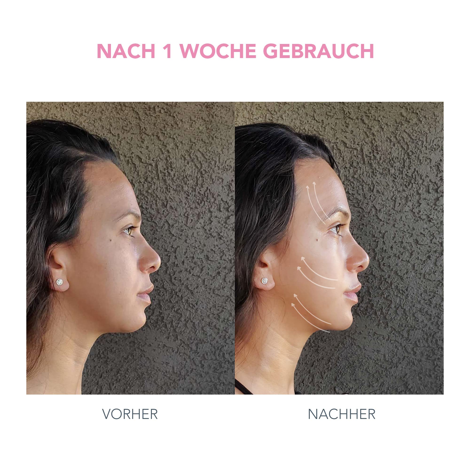 BEAR mini + Supercharged Triple-Action Straffungsserum 30 ml Set | Mikrostrom-Gesichtsgerät, Gesichtsmassagegerät, Straffungsserum, Hautpflege, Gesichtstoning, Anti-Aging, Falten, Reise
